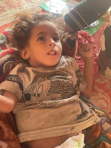 صورة الطفلة المعاقة جسديآ